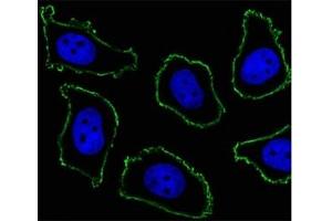 Fluorescent image of A549 cell stained with CD33 antibody at 1:25. (CD33 antibody  (AA 337-364))