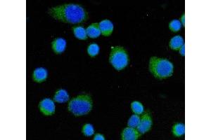 IF analysis of CD55 using anti-CD55 antibody (ABIN7601423).