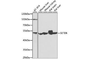 Western blot analysis of extracts of various cell lines, using SETD6 antibody (ABIN4905136) at 1:1000 dilution. (SETD6 antibody)