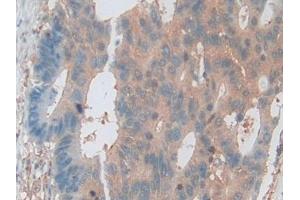 Immunohistochemistry (IHC) image for anti-V-Akt Murine Thymoma Viral Oncogene Homolog 3 (Protein Kinase B, Gamma) (AKT3) (AA 46-338) antibody (ABIN7431704)