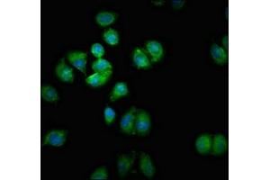 Immunofluorescent analysis of A549 cells using ABIN7170545 at dilution of 1:100 and Alexa Fluor 488-congugated AffiniPure Goat Anti-Rabbit IgG(H+L) (SMOX antibody  (AA 268-353))