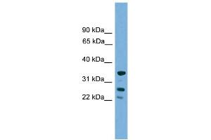WB Suggested Anti-H1FOO Antibody Titration: 0. (H1FOO antibody  (Middle Region))