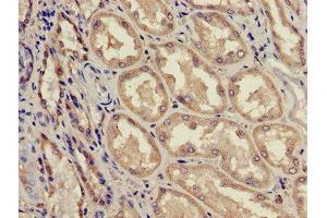 Immunohistochemistry of paraffin-embedded human kidney tissue using ABIN7143187 at dilution of 1:100 (ACAD11 antibody  (AA 225-388))