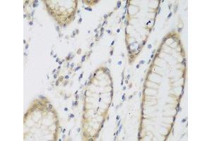 Immunohistochemistry of paraffin-embedded Human stomach using NAT8B Polyclonal Antibody at dilution of 1:200 (40x lens). (NAT8B antibody)