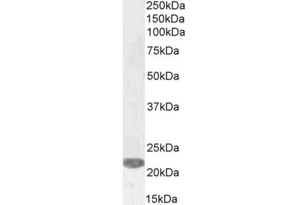 PRRX1 antibody  (Internal Region)