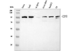 Western blot analysis of CD19 using anti-CD19 antibody (ABIN5693173).