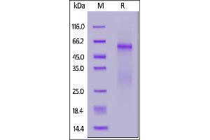 SDS-PAGE (SDS) image for SARS-CoV-2 Nucleocapsid (SARS-CoV-2 N) (D3L), (G204R), (R203K), (S235F) protein (His tag) (ABIN6971314)