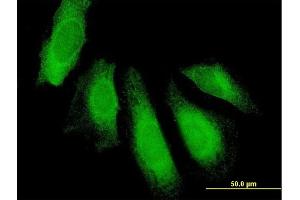 Immunofluorescence of purified MaxPab antibody to UBAP1 on HeLa cell. (UBAP1 antibody  (AA 1-502))