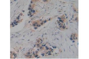 Figure. (PLAT antibody  (AA 311-562))