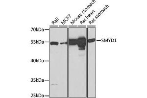 Western blot analysis of extracts of various cell lines, using SMYD1 Antibody (ABIN6128707, ABIN6148163, ABIN6148165 and ABIN6219496) at 1:1000 dilution. (SMYD1 antibody  (AA 1-350))