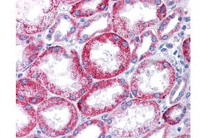 Immunohistochemistry (IHC) image for anti-Potassium Voltage-Gated Channel, KQT-Like Subfamily, Member 1 (KCNQ1) (N-Term) antibody (ABIN2776085) (KCNQ1 antibody  (N-Term))