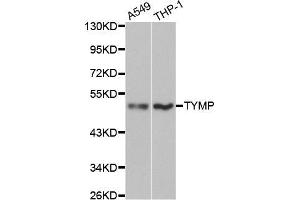 Western blot analysis of extracts of various cell lines, using TYMP antibody (ABIN5970450) at 1/1000 dilution. (Thymidine Phosphorylase antibody)