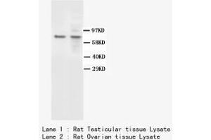 Image no. 1 for anti-BRCA1 Associated Protein-1 (Ubiquitin Carboxy-terminal Hydrolase) (BAP1) antibody (ABIN1502051)