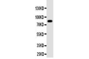 Western Blotting (WB) image for anti-Proprotein Convertase Subtilisin/kexin Type 4 (PCSK4) (AA 117-133), (N-Term) antibody (ABIN3042910) (PCSK4 antibody  (N-Term))