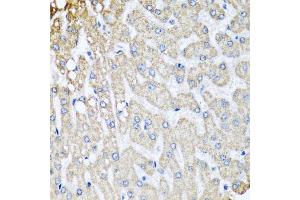 Immunohistochemistry of paraffin-embedded human liver injury using COX5B antibody. (COX5B antibody)