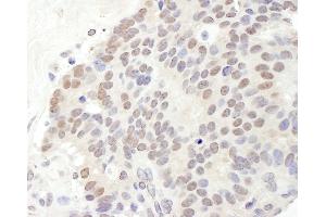 anti-Trichorhinophalangeal Syndrome I (TRPS1) (AA 1-50) antibody