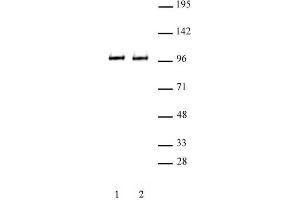 BRD3 antibody (pAb) tested by Western blot. (BRD3 antibody  (C-Term))