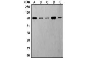 Western blot analysis of S6K1 (pT421) expression in MDAMB231 insulin-treated (A), Jurkat (B), HeLa (C), NIH3T3 (D), PC12 (E) whole cell lysates. (RPS6KB1 antibody  (C-Term, pSer421))