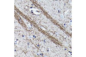 Immunohistochemistry of paraffin-embedded human brain using CNPase Rabbit mAb (ABIN7265322) at dilution of 1:100 (40x lens). (Cnpase antibody)