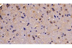 Detection of EPOR in Mouse Cerebrum Tissue using Polyclonal Antibody to Erythropoietin Receptor (EPOR) (EPOR antibody  (AA 45-244))