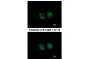 ICC/IF Image Immunofluorescence analysis of methanol-fixed A549, using IL1 Receptor 2, antibody at 1:500 dilution. (IL1R2 antibody)