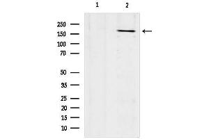 anti-Collagen, Type XVII (COL17) (N-Term) antibody