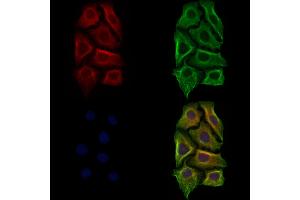 ABIN7094475 and ABIN7098523 staining Hela cells by IF/ICC.