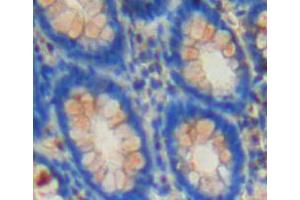 IHC-P analysis of rectum tissue, with DAB staining. (CSN2 antibody  (AA 41-198))