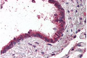 Human Lung, Respiratory Epithelium (formalin-fixed, paraffin-embedded) stained with AP1G1 antibody ABIN295688 at 2. (gamma 1 Adaptin antibody  (AA 646-659))