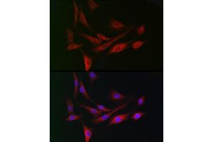 Immunohistochemistry of paraffin-embedded human lung cancer using DC Rabbit pAb (ABIN6132184, ABIN6139432, ABIN6139434 and ABIN6222532) at dilution of 1:150 (40x lens). (DCAF7 antibody  (AA 1-342))