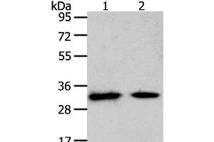Western Blot analysis of Mouse heart and muscle tissue using SLC25A4 Polyclonal Antibody at dilution of 1:400 (SLC25A4 antibody)