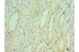 Immunohistochemistry of paraffin-embedded human kidney tissue using ABIN7171754 at dilution of 1:100 (TNXB antibody  (AA 3933-4242))