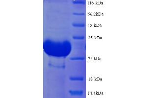 SDS-PAGE (SDS) image for Deiodinase, Iodothyronine, Type III (DIO3) (AA 37-278), (Extracellular) protein (His tag) (ABIN5714130) (DIO3 Protein (AA 37-278, Extracellular) (His tag))