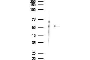 anti-Septin 4 (SEPT4) (Internal Region) antibody