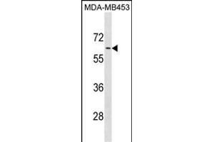 ADRA1B Antibody (C-term) (ABIN1881048 and ABIN2838875) western blot analysis in MDA-M cell line lysates (35 μg/lane). (ADRA1B antibody  (C-Term))