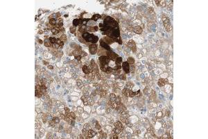 Immunohistochemical staining (Formalin-fixed paraffin-embedded sections) of human adrenal gland with FDFT1 polyclonal antibody  shows strong cytoplasmic positivity in cortical cells.