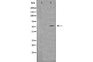 Western blot analysis of extracts from LOVO cells, using SLC30A1 antibody. (SLC30A1 antibody  (Internal Region))