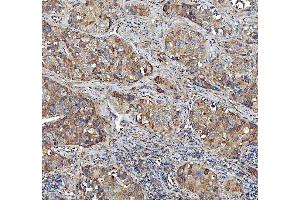 IHC analysis of Kindlin 2/FERMT2 using anti-Kindlin 2/FERMT2 antibody (ABIN7599515). (FERMT2 antibody  (AA 1-650))
