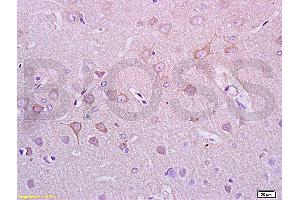 Formalin-fixed and paraffin embedded rat brain tissue with labeled Anti-Alpha-Synuclein/Syn/SNCA Polyclonal Antibody, Unconjugated (ABIN730393) at 1:200, followed by conjugation to the secondary antibody and DAB staining (SNCA antibody  (AA 1-140))