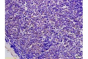 Formalin-fixed and paraffin embedded mouse colon carcinoma labeled with Anti-AMPK beta 1 Polyclonal Antibody, Unconjugated (ABIN737901) at 1:200 followed by conjugation to the secondary antibody and DAB staining. (PRKAB1 antibody  (AA 201-270))