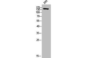 Western Blot analysis of 293 cells using DCC Polyclonal Antibody (DCC antibody  (Internal Region))