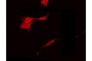 ABIN6275299 staining 293 by IF/ICC. (NBPF1,9,10,12,14,15,16,20 antibody)