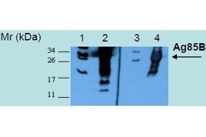 Western Blotting analysis of recombinant protein Ag85B produced in Escherichia coli BL21 (lambdaDE3) transfected bacterial culture. (Mycobacterium Tuberculosis Ag85 antibody)