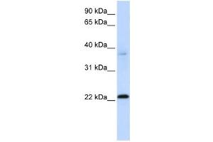 Western Blotting (WB) image for anti-Chromosome 11 Open Reading Frame 74 (C11ORF74) antibody (ABIN2459550)