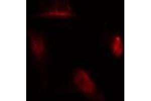 ABIN6275902 staining  A549 cells by IF/ICC. (MAD2L1 antibody  (Internal Region))