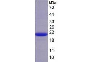 SDS-PAGE analysis of Pig AMH Protein. (AMH Protein)