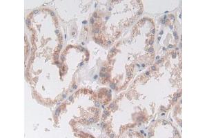 Used in DAB staining on fromalin fixed paraffin- embedded Kidney tissue (Deoxyribonuclease II (AA 19-360) antibody)