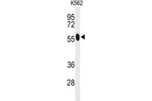 Western Blotting (WB) image for anti-Acyl-CoA Synthetase Medium-Chain Family Member 1 (ACSM1) antibody (ABIN3004114) (ACSM1 antibody)