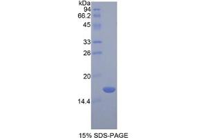 SDS-PAGE analysis of Rat Chemerin Protein. (Chemerin Protein)