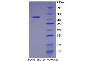 SDS-PAGE (SDS) image for Alanine Aminotransferase (ALT) (AA 16-64) protein (His tag,GST tag) (ABIN2122369)